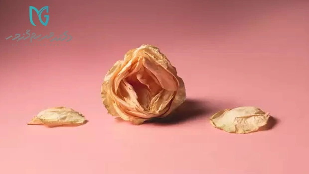 لابیاپلاستی